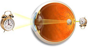 http://www.rusmedserv.com/files/ophthalmolog/gmetr_p1.jpg