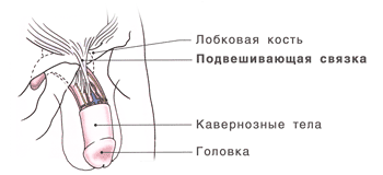 Удлинение полового члена - хирургический метод