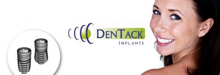 Импланты Dentack