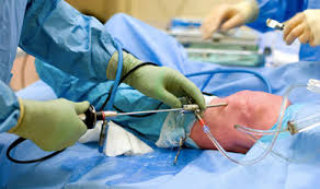 Артроскопическая операция