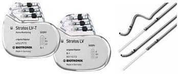 бивентрикулярный электрокардиостимулятор