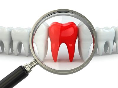 Депульпирование зуба