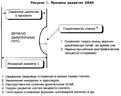 Нарушение дыхания во сне храп. p1. Нарушение дыхания во сне храп фото. Нарушение дыхания во сне храп-p1. картинка Нарушение дыхания во сне храп. картинка p1. Рассказываем, чем так опасно сонное апноэ — остановка дыхания во сне. И почему нужно срочно лечить апноэ, если у вас или ваших родных есть симптомы.