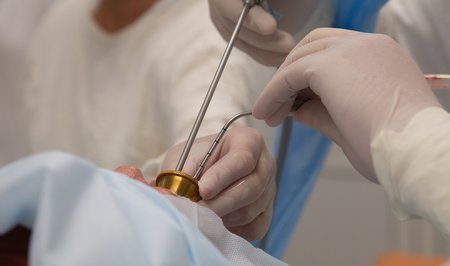 Эндоскопия в челюстной хирургии Германии