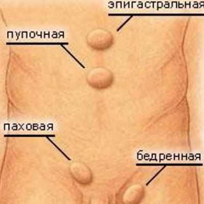 Яйца уходят под кожу Яйца уходят под кожу