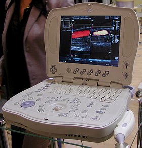 LOGIQ Book - портативный ультразвуковой сканер производства GE Medical System - ЗДРАВООХРАНЕНИЕ-2002 - Pепортаж РМС-Экспо