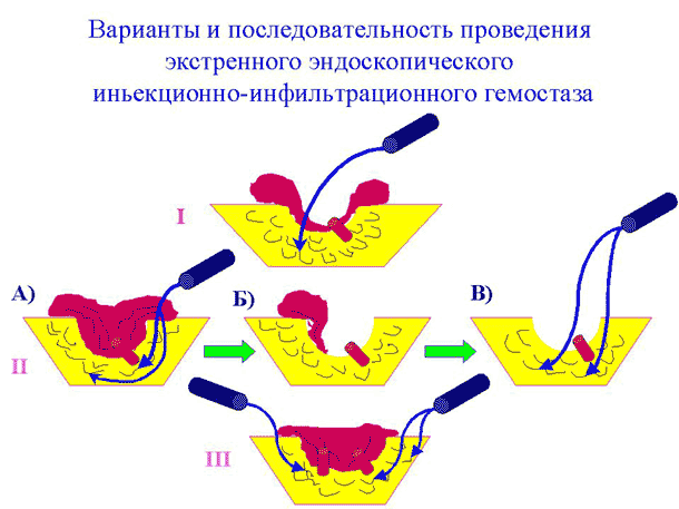 Слайд № 17