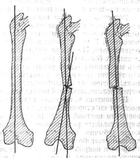 111.jpg (16791 bytes)