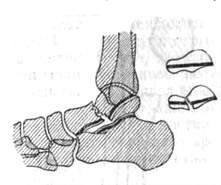 116.jpg (12481 bytes)