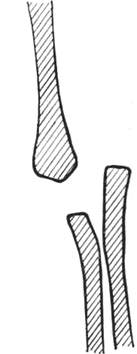 118.jpg (6726 bytes)