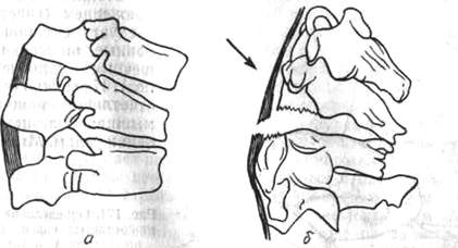 170.jpg (16409 bytes)