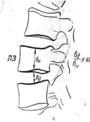202.jpg (6162 bytes)