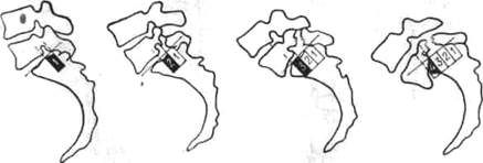 214.jpg (10166 bytes)