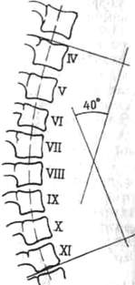 215.jpg (8553 bytes)