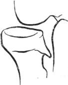 268.jpg (3408 bytes)