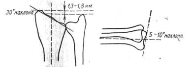 301.jpg (6501 bytes)