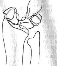 302.jpg (6982 bytes)