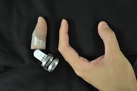 Протезирование пальцев