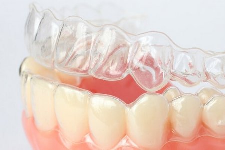 Невидимые съемные капы Invisalign (Инвизилайн) в Германии