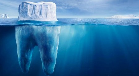 Удаление зубов мудрости в Германии