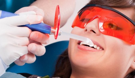 Удаление зубного камня в Германии