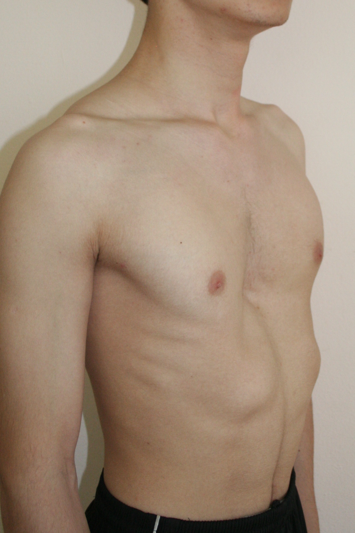 ямки на груди у мужчин фото 114